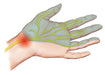 Healing Crystal Kit for Carpel Tunnel Syndrome including Amazonite, Blue Lace Agate, Green Tourmaline, Amber, and Copper, perfect for relief from discomfort and enhancing healing.